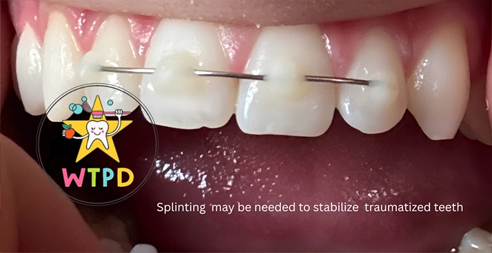 Emergency Splinting